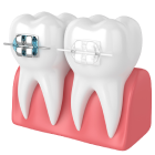 Зубные протезы вида 